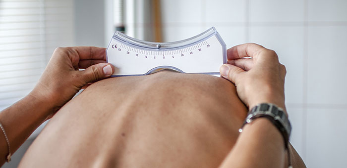 patient needing scoliosis treatment in Ontario