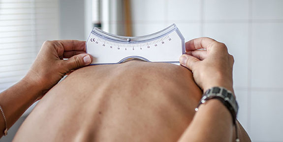 scoliosis Treatment in Ontario