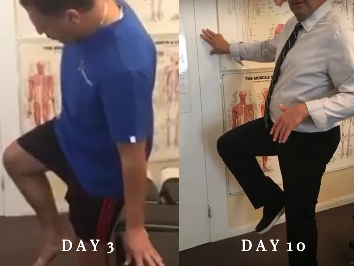 Knee Pain Treatment, Non-Invasive Approach tips from Ontario chiropractor