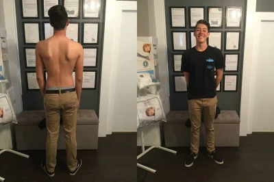 La Verne Scoliosis Chiropractic Treatment tips from Ontario chiropractor